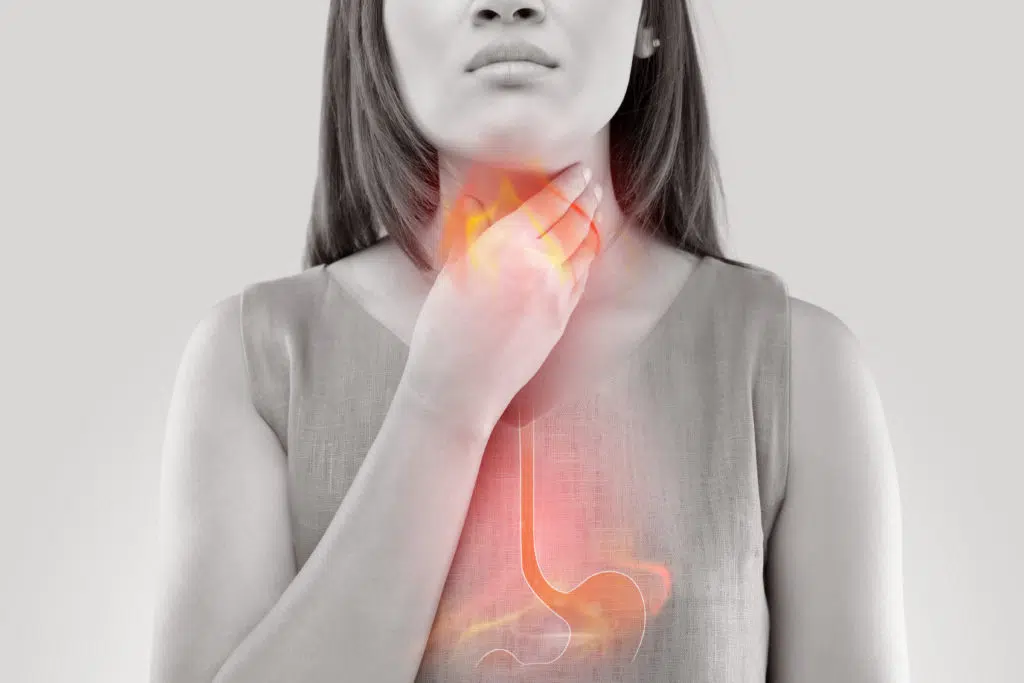 Canva-Woman-Suffering-From-Acid-Reflux-Or-Heartburn-Isolated-On-White-Background-copia-1024x683