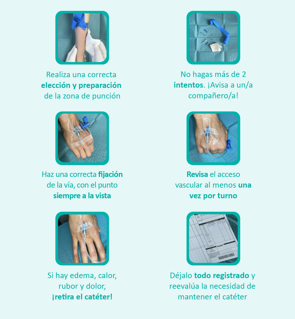 ¿Cómo colocar correctamente un catéter venoso? Quirónsalud