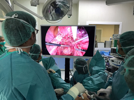 El Hospital Universitario Dexeus Aplica Por Primera Vez En Espana Una Nueva Tecnologia Menos Agresiva Para La Cirugia De Endometriosis Quironsalud
